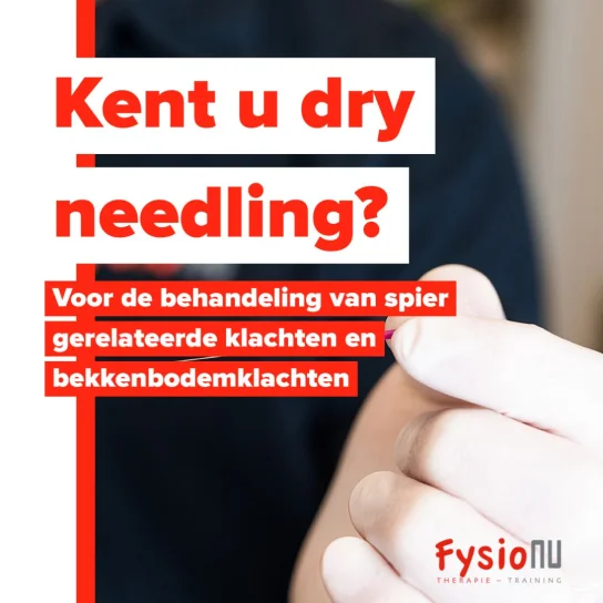 Dry Needling